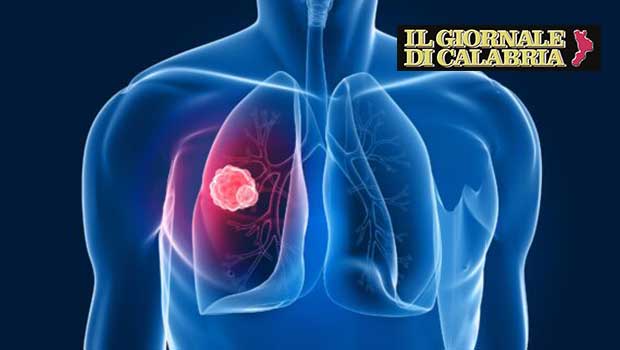 The PDTA of lung cancer: certification as the first success of the new hospital